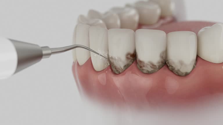 Trusted Wisdom Tooth Removal service in Long Beach, WA - Dentist Open Now